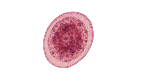 Verme Blastocystis hominis