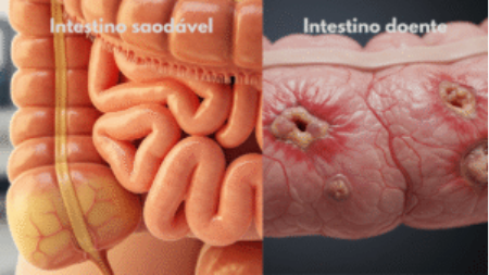 Prevenção de Doenças Intestinais 
